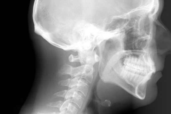 Close-up shot of X-ray film with image of human head